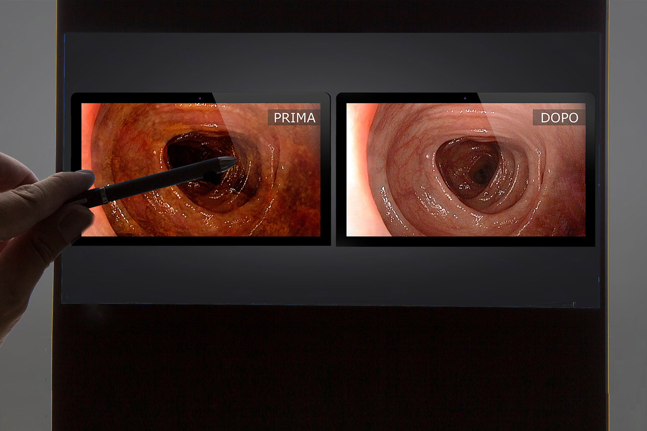Idrocolonterapia-Brescia Idrocolonterapia-Brescia