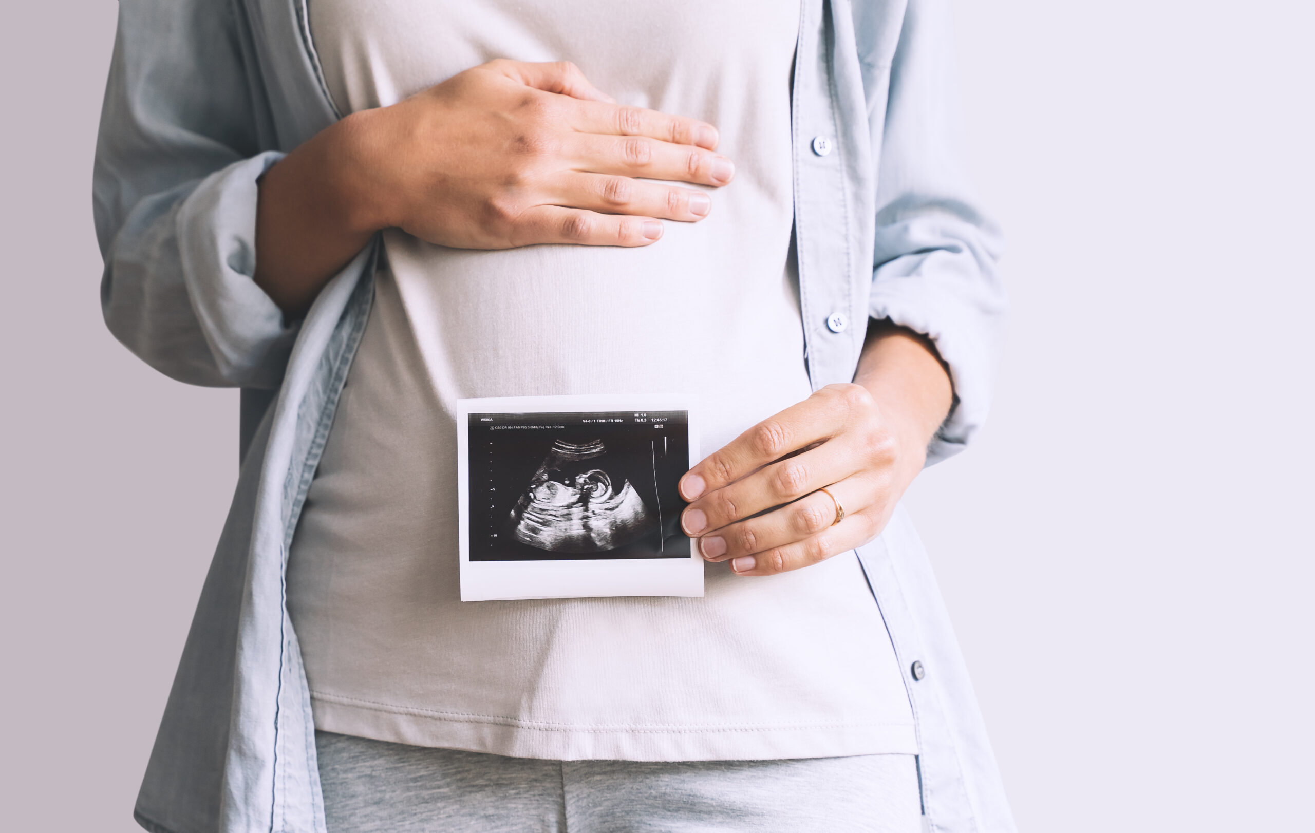 Pregnant woman holding ultrasound baby image.